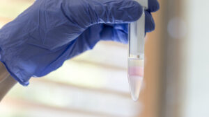 Schweizer Männer in ländlichen Regionen haben schlechtere Spermien