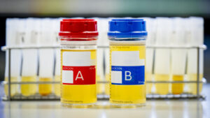 In Epalinges taucht man ins Herz der Dopinganalyse ein